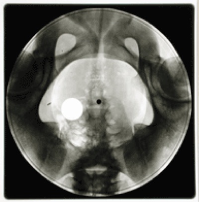 x-ray1.jpg