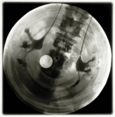 x-ray3.jpg